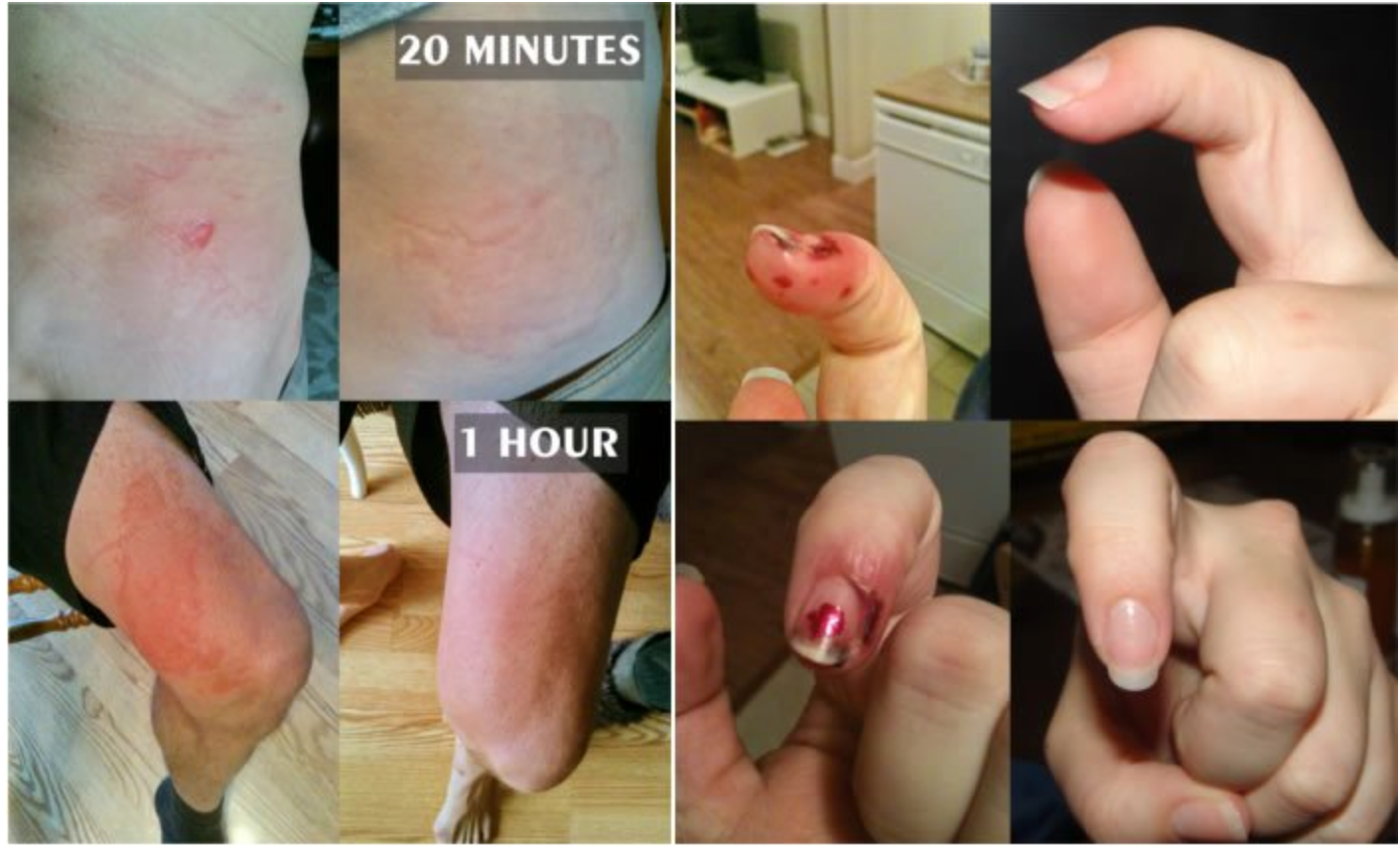 Trauma Gel Complex | Skin Sorcery