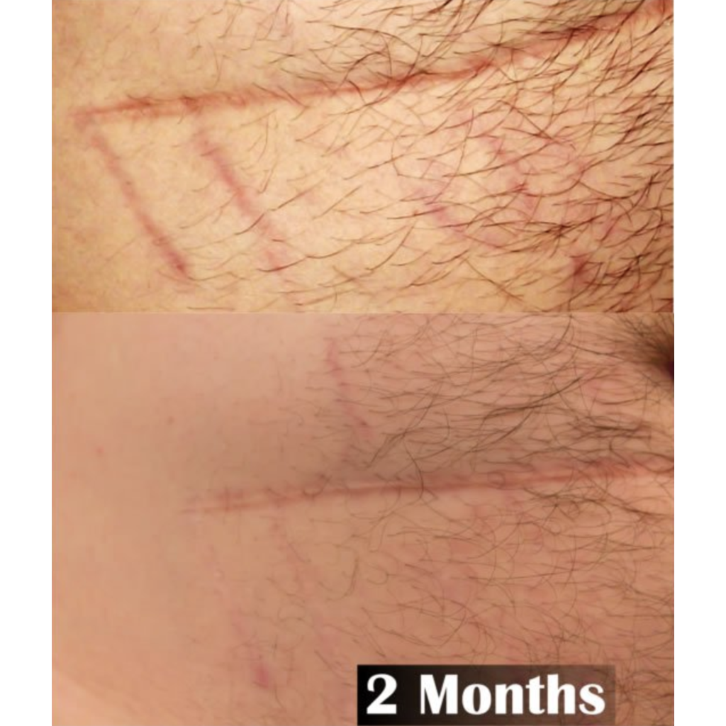 Trauma Gel Complex | Skin Sorcery