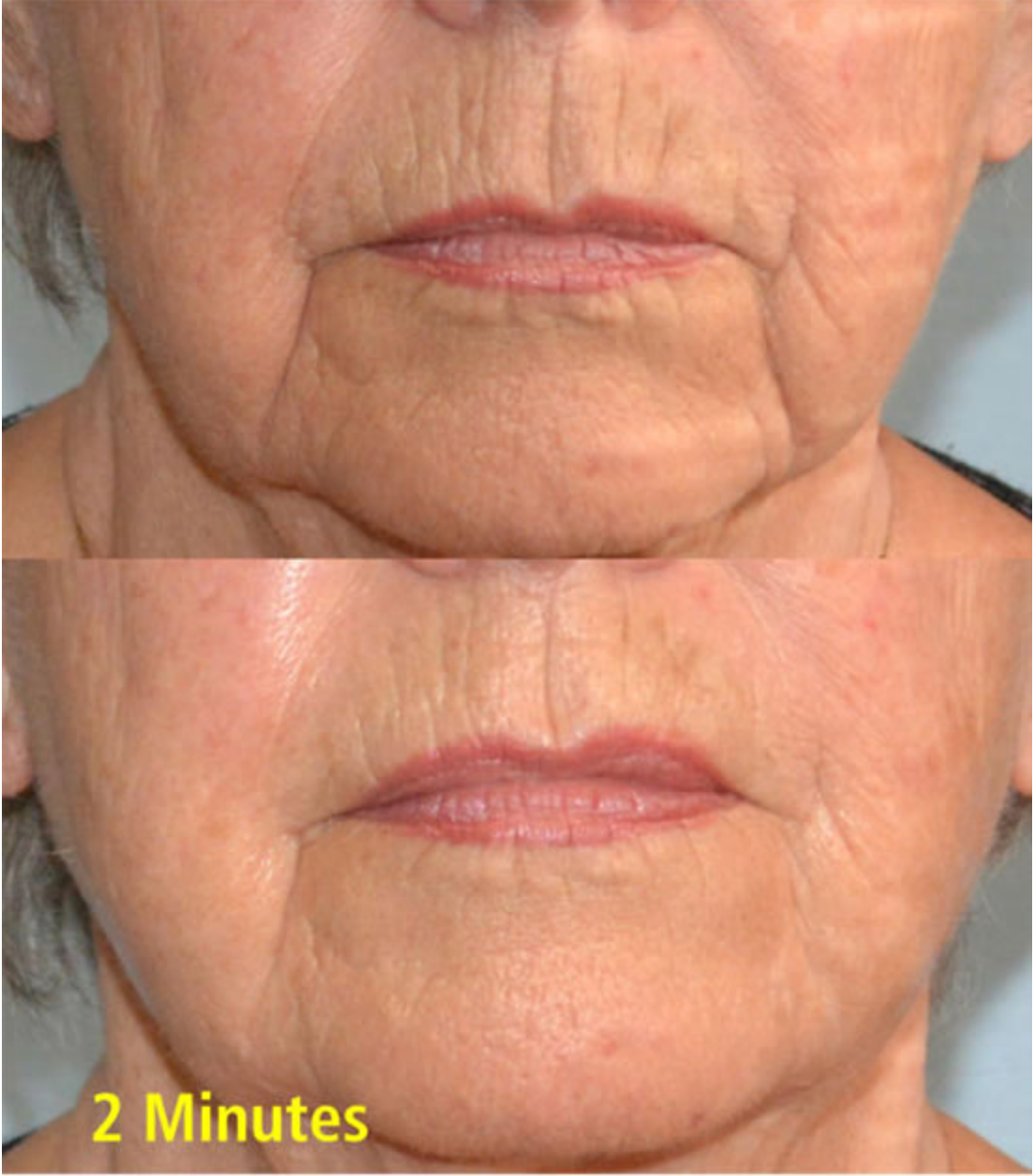 Wrinkle Removing Complex | Skin Sorcery