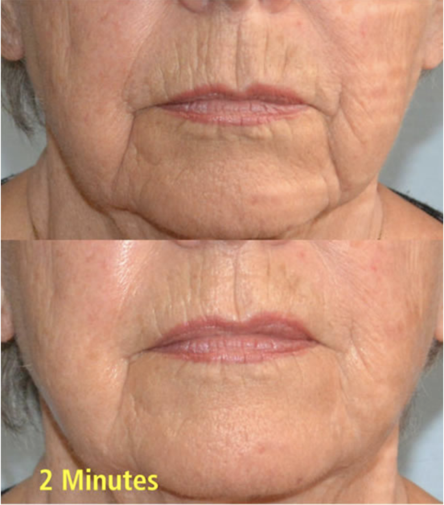 Hydrating & Anti-Aging Duo (Hyaluronic Acid & Wrinkle Removing Complex) | Skin Sorcery
