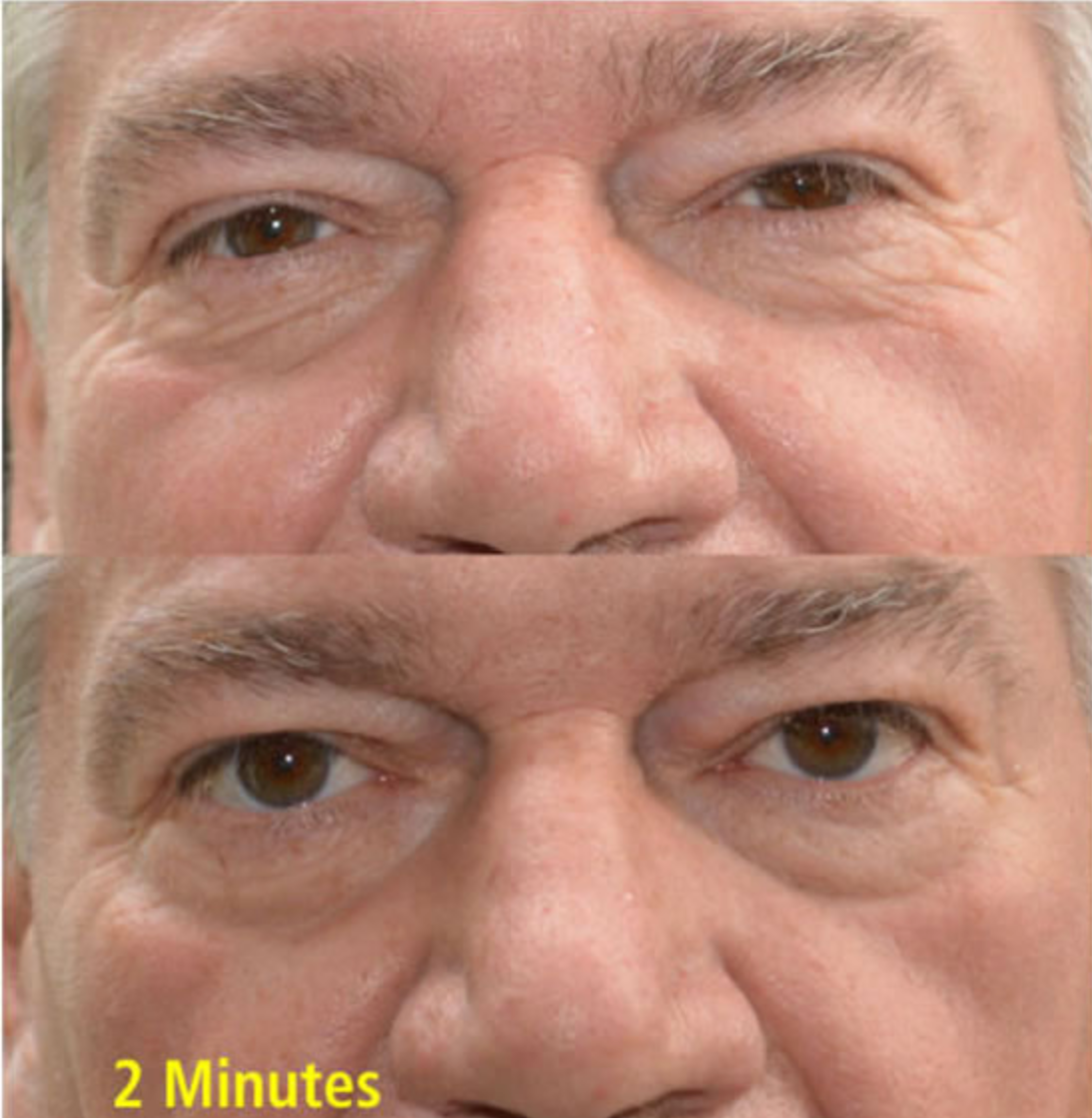 Wrinkle Removing Complex | Skin Sorcery