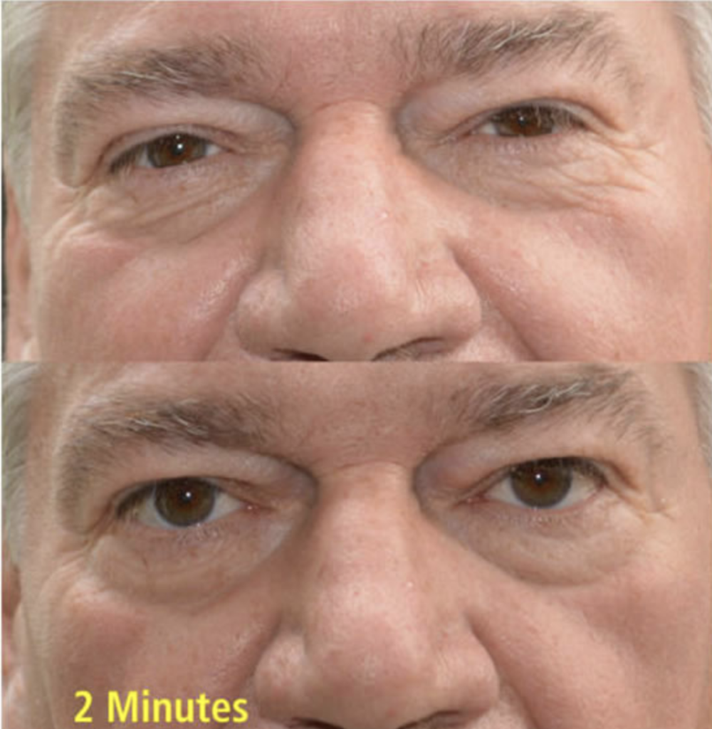 Hydrating & Anti-Aging Duo (Hyaluronic Acid & Wrinkle Removing Complex) | Skin Sorcery