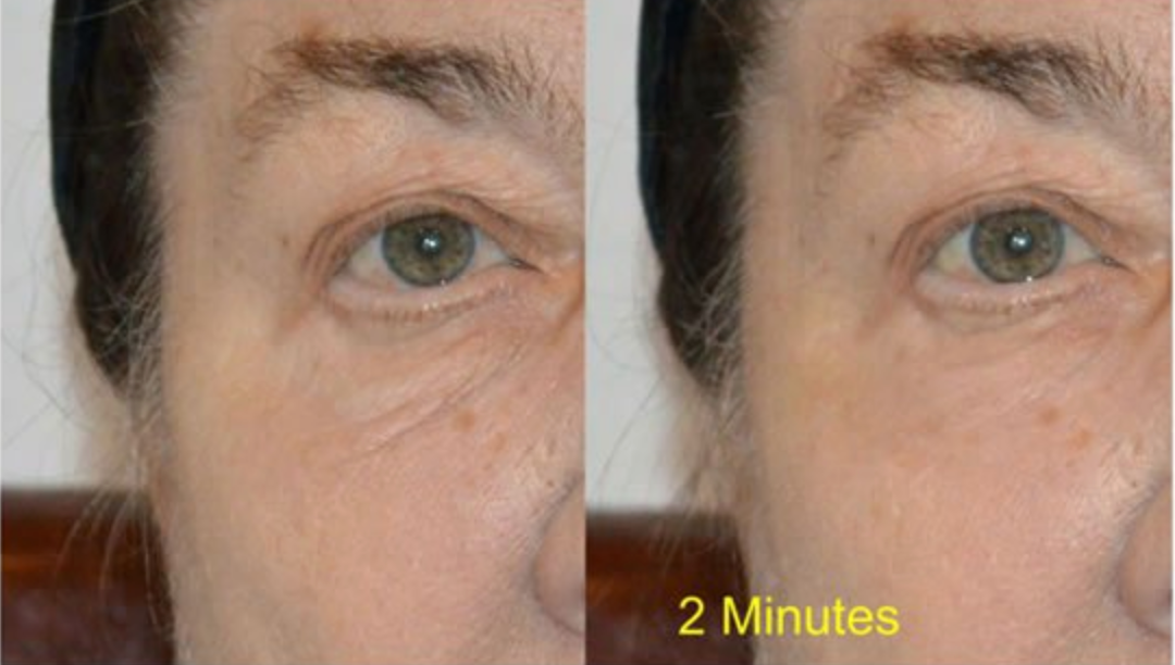 Wrinkle Removing Complex | Skin Sorcery