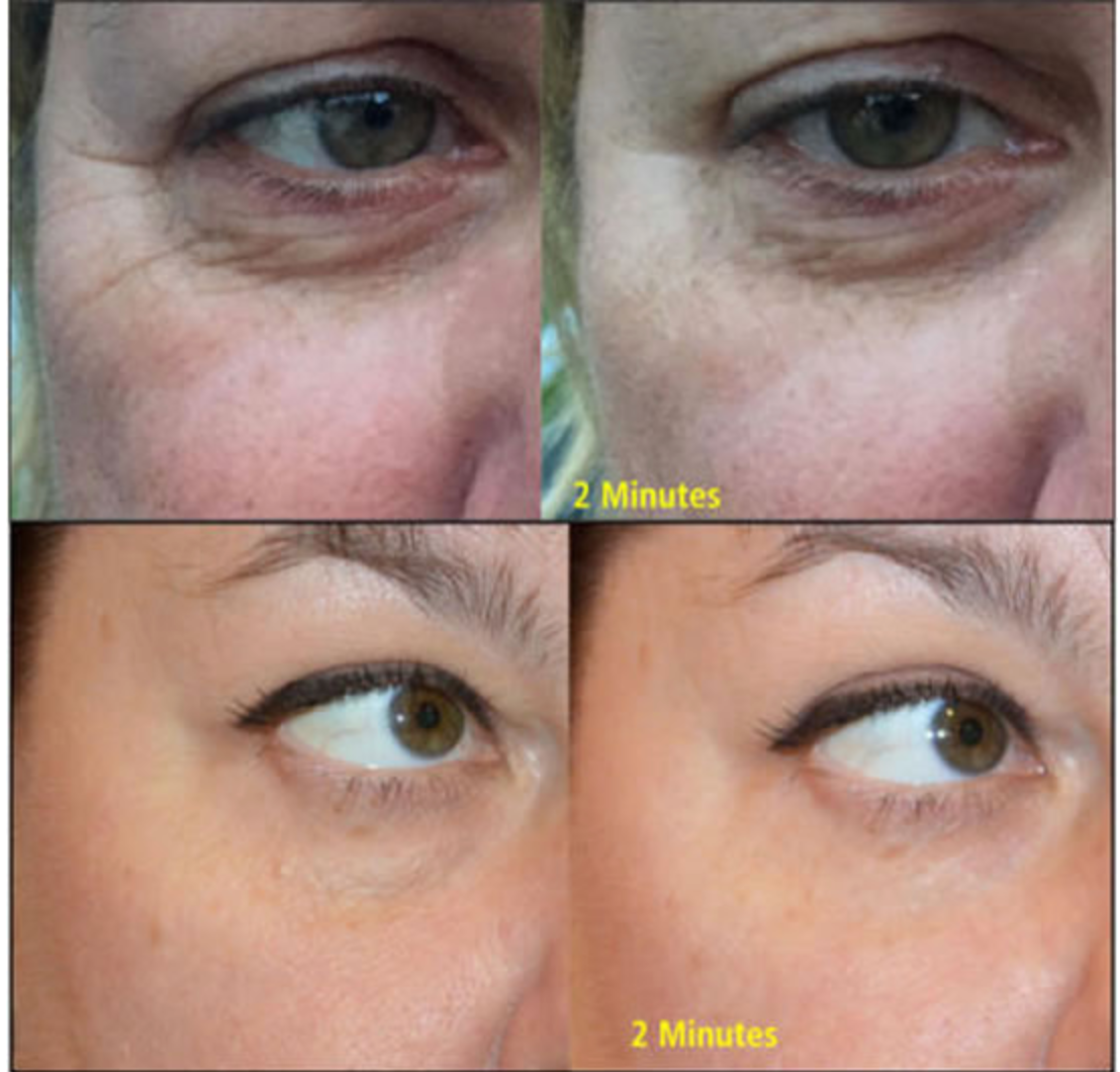 Wrinkle Removing Complex | Skin Sorcery