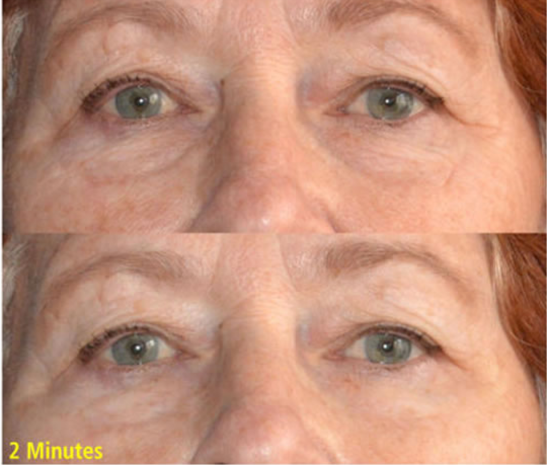 Wrinkle Removing Complex | Skin Sorcery
