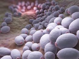Don’t invite Candida into your colon – the causes of Candida