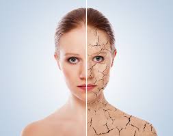 Harsh Winter Got You Down? Save Your Skin with Salve!