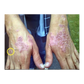 Trauma Gel Complex Duo (2 pack) | Skin Sorcery