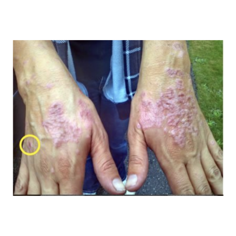 Trauma Gel Complex Duo (2 pack) | Skin Sorcery