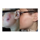 Trauma Gel Complex Duo (2 pack) | Skin Sorcery