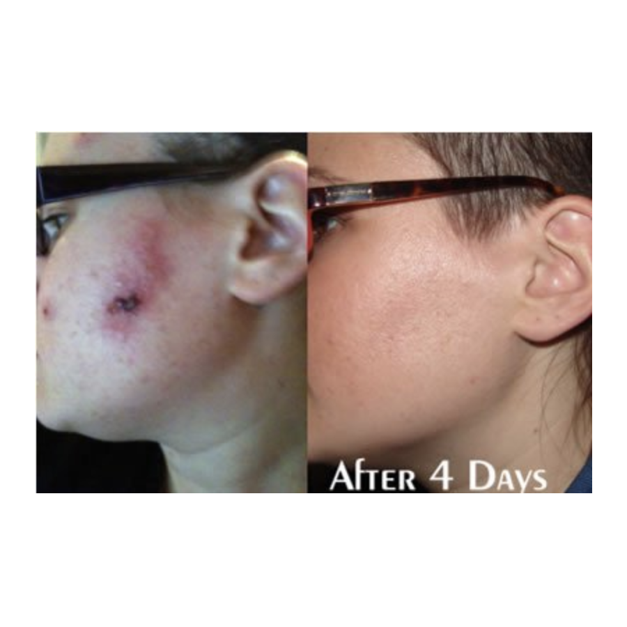 Trauma Gel Complex Duo (2 pack) | Skin Sorcery