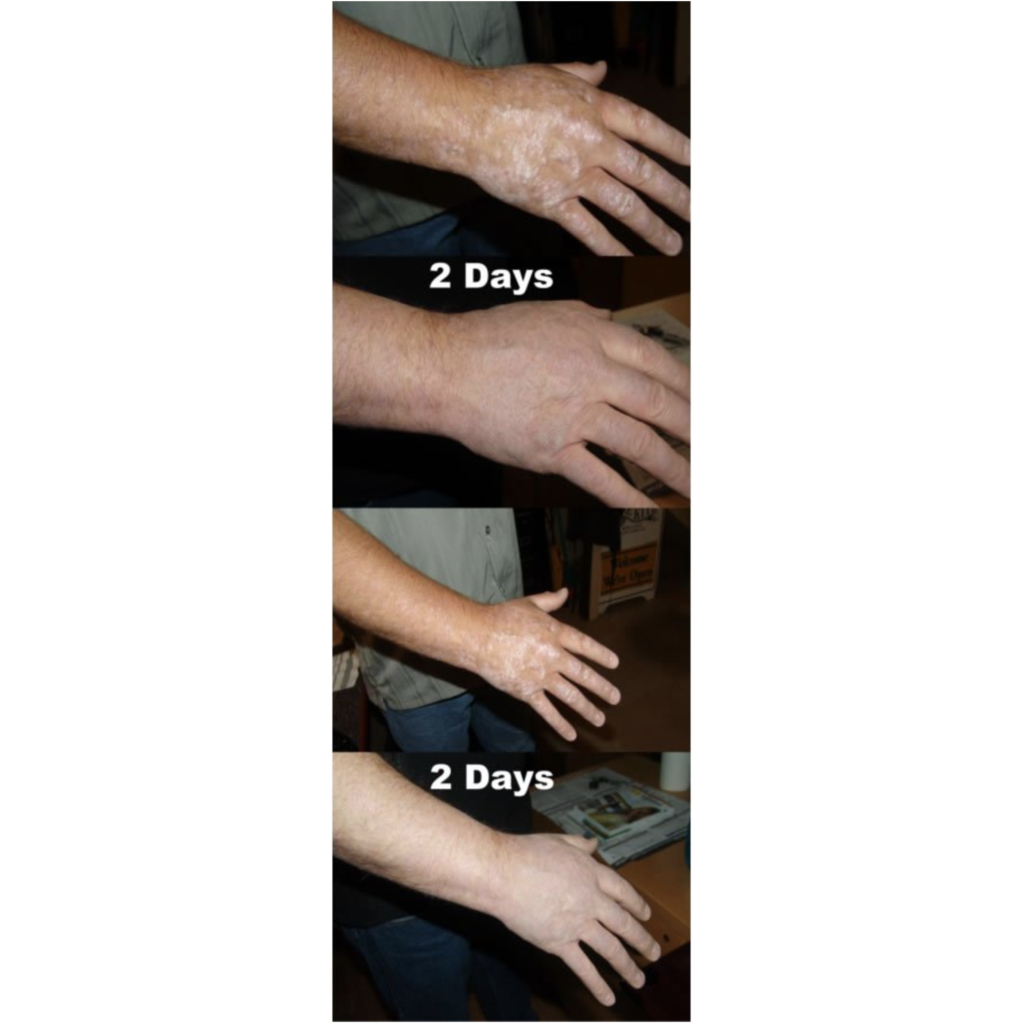 Trauma Gel Complex Duo (2 pack) | Skin Sorcery
