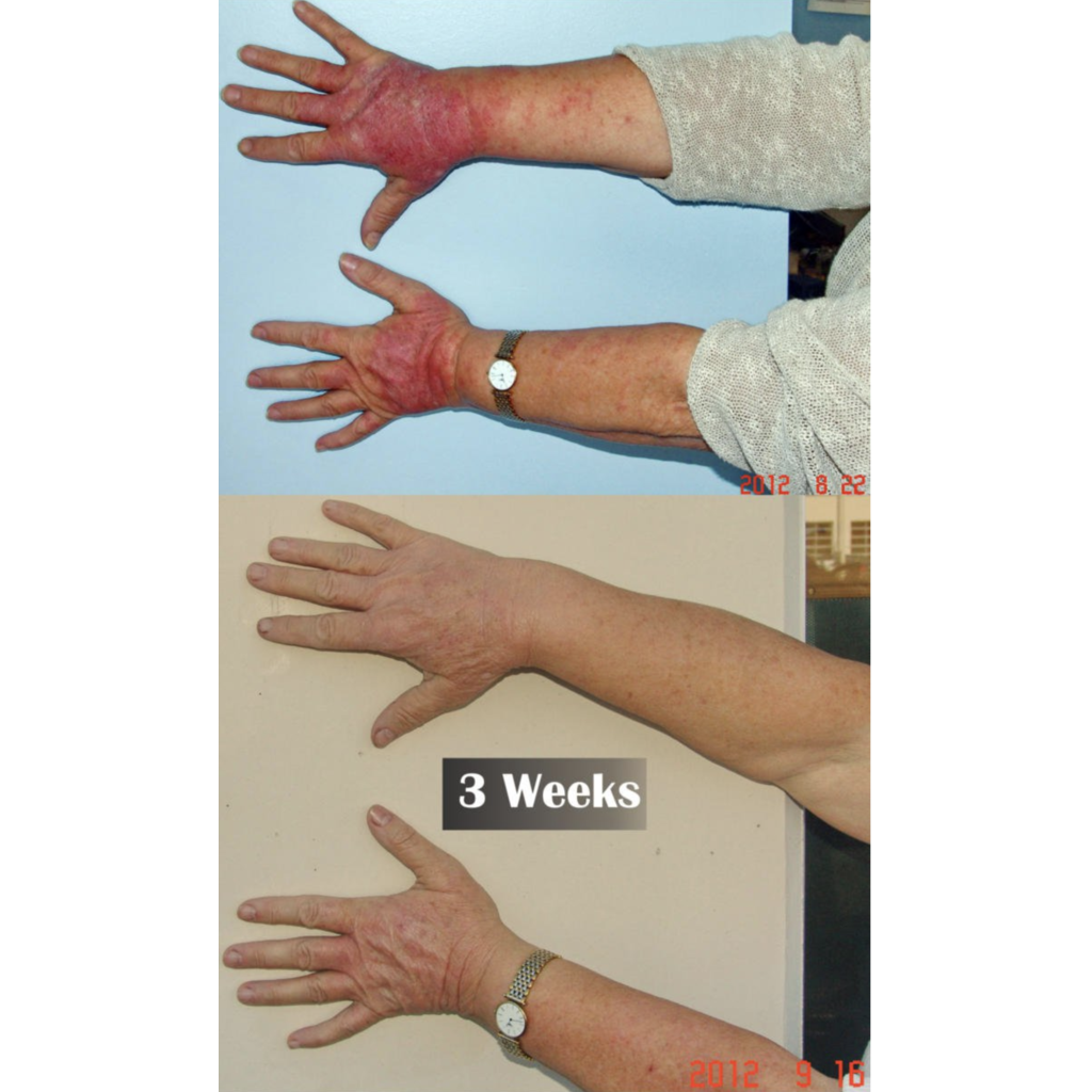 Trauma Gel Complex Duo (2 pack) | Skin Sorcery