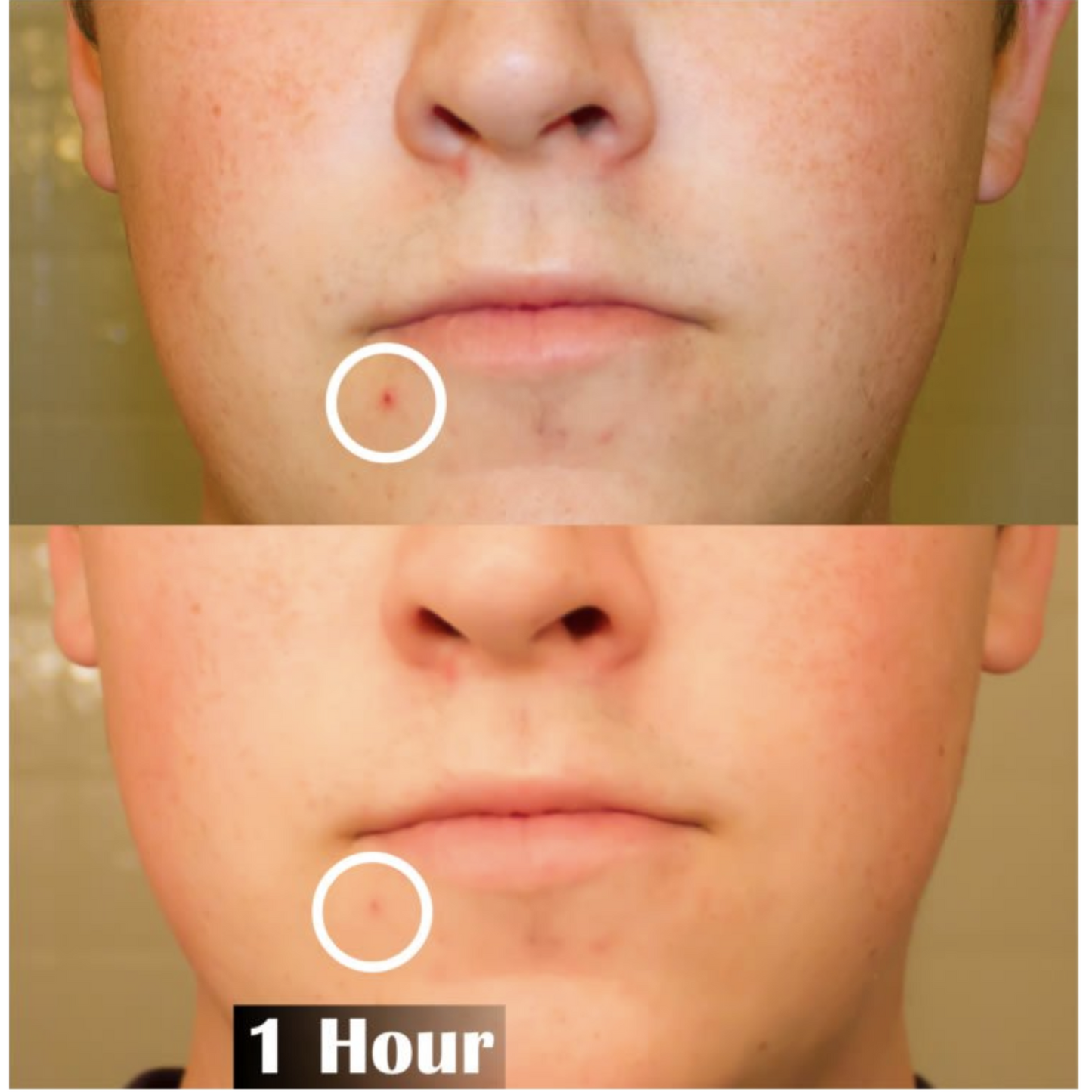 Trauma Gel Complex Duo (2 pack) | Skin Sorcery