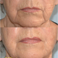 Refreshed & Rejuvenated Duo (Actif Protection & Wrinkle Removing Complex) | Skin Sorcery