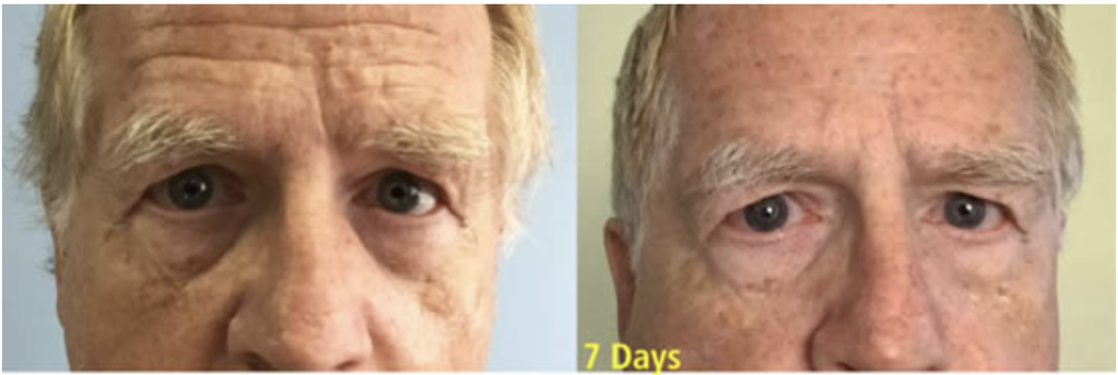 Refreshed & Rejuvenated Duo (Actif Protection & Wrinkle Removing Complex) | Skin Sorcery