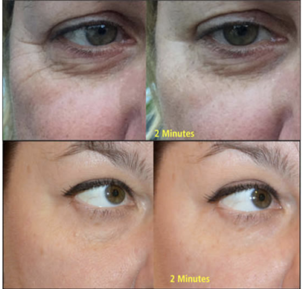 Hydrating & Anti-Aging Duo (Hyaluronic Acid & Wrinkle Removing Complex) | Skin Sorcery