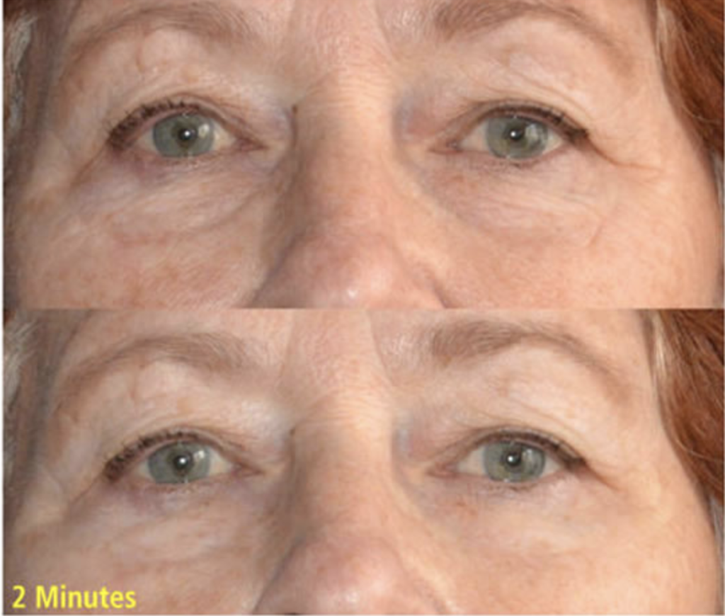 Hydrating & Anti-Aging Duo (Hyaluronic Acid & Wrinkle Removing Complex) | Skin Sorcery