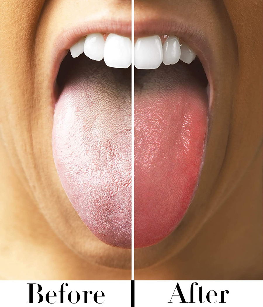 100% Pure Unalloyed Copper Tongue Cleaner<br>Viv Vitals